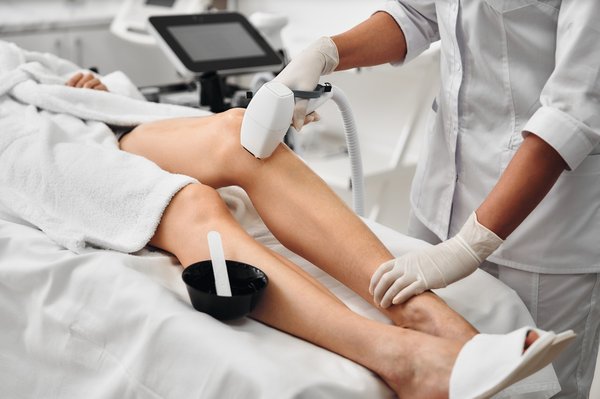 Épilation définitive à caen : la méthode laser qui change tout